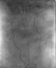 Untitled (Standing Female Nude with Robe)