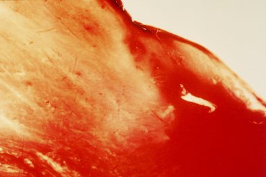 Andres Serrano (American, born 1950). <em>Blood and Semen V</em>, 1990. Silver dye bleach photograph (Cibachrome), 20 x 24 in. (50.8 x 61 cm). Brooklyn Museum, Purchased with funds given by Karen B. Cohen, 1997.130.2. © artist or artist's estate (Photo: Brooklyn Museum, 1997.130.2_transpc002.jpg)