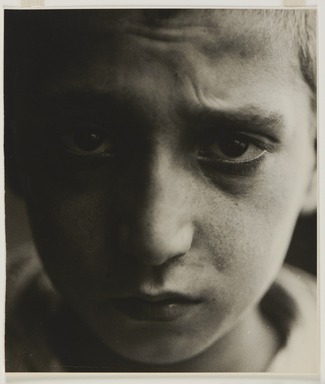Consuelo Kanaga (American, 1894-1978). <em>Malnutrition</em>, 1928. Gelatin silver print, frame: 22 13/16 × 16 13/16 × 1 1/2 in. (57.9 × 42.7 × 3.8 cm). Brooklyn Museum, Gift of Wallace B. Putnam from the Estate of Consuelo Kanaga, 82.65.447 (Photo: Brooklyn Museum, 82.65.447_PS20.jpg)