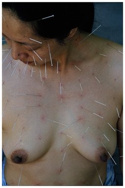He Chengyao (Chinese, born 1964). <em>99 Needles</em>, 2002. Chromogenic photograph, 45 x 30 1/4 in. (114.3 x 76.8 cm). Brooklyn Museum, Gift of the artist, 2007.25.2. © artist or artist's estate (Photo: Photograph courtesy of the artist, CUR.2007.25.2.jpg)